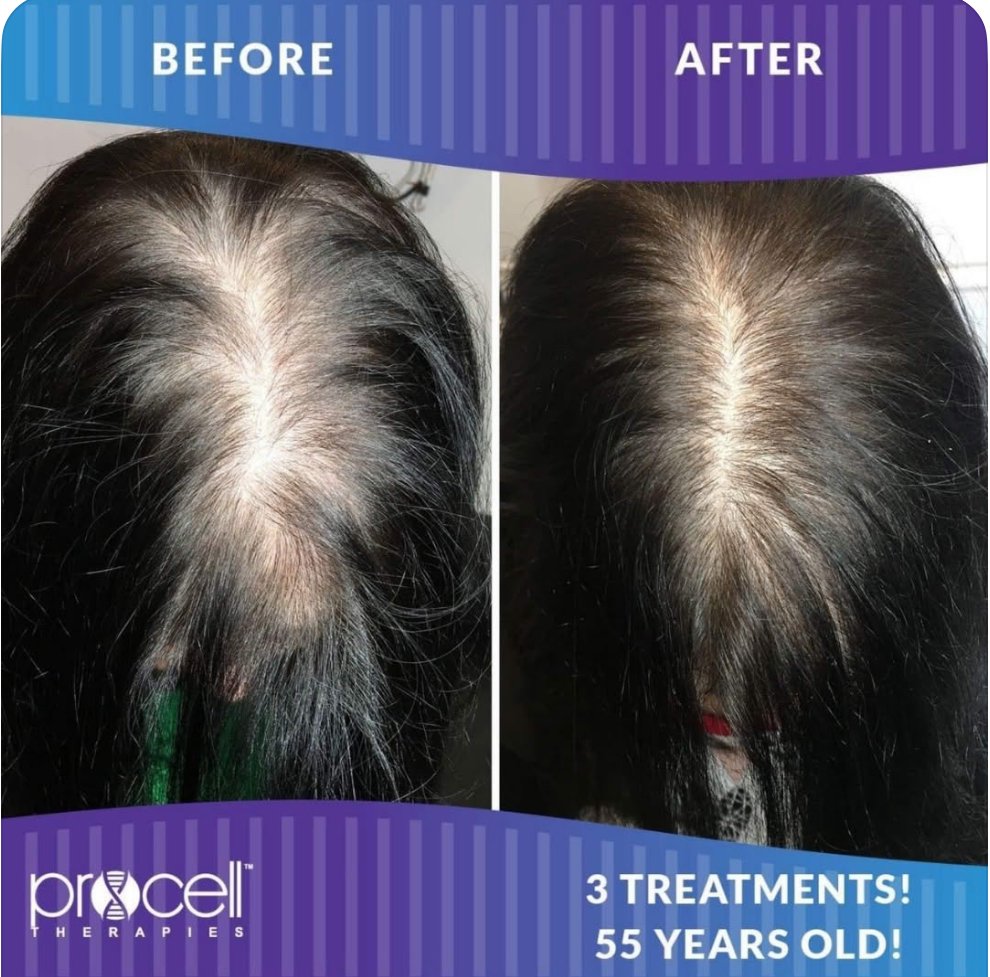 Scalp Rejuvenation: Clinical Approaches to Hair Health at Exotica skin care Henderson