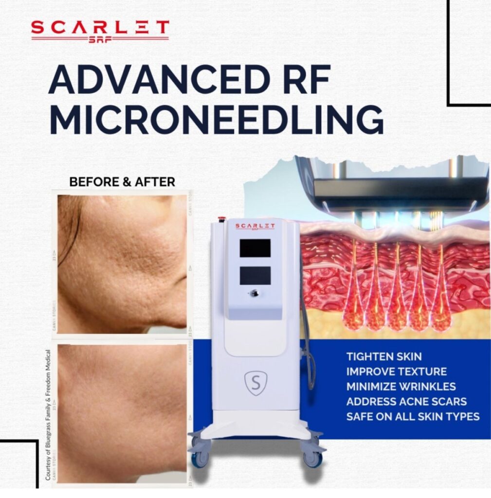 non-surgical neck lift Summerlin Best Practices and Expert Advice at Exotica skin care Henderson